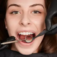 5 motive pentru care să-ți faci un detartraj dentar